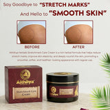 Aithihya Herbals Ayurvedic Stretch Mark Care Cream | Reduces Stretch Marks, Improves Skin Elasticity & Hydration | Herbal Formula for All Skin Types | 50g