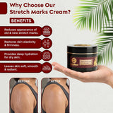 Aithihya Herbals Ayurvedic Stretch Mark Care Cream | Reduces Stretch Marks, Improves Skin Elasticity & Hydration | Herbal Formula for All Skin Types | 50g